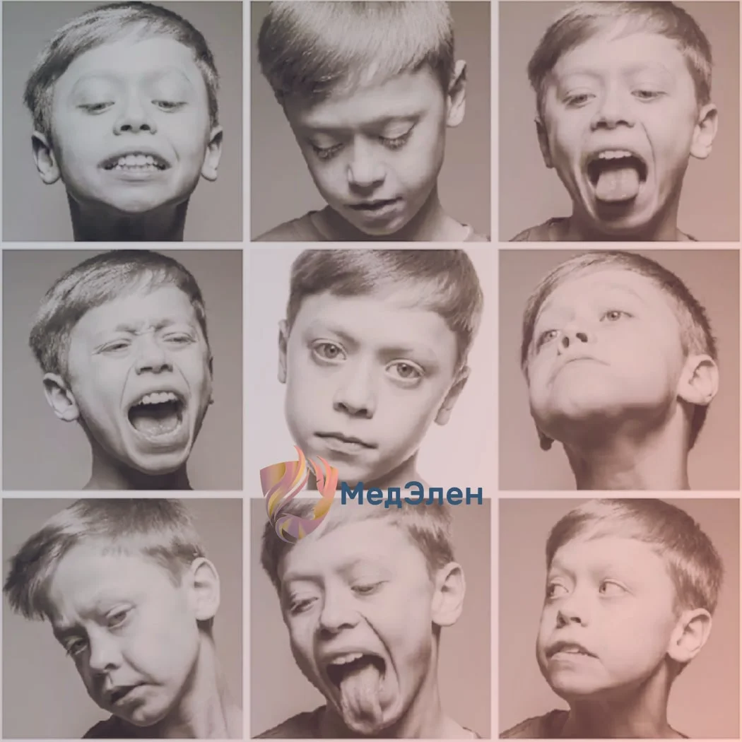 Проявления синдрома Туретта